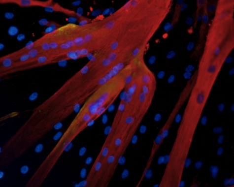 Synthetic skeletal muscle acts just like human skeletal muscle. Photo from yalescientific.org